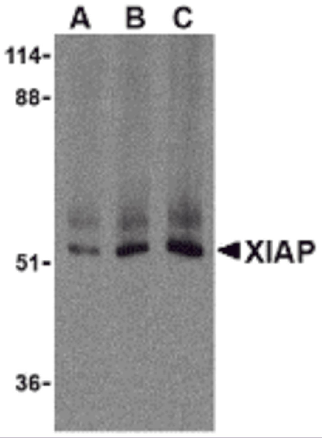 Western blot analysis of XIAP in human kidney lysate with XIAP antibody at (A) 0.5, (B) 1 , and (C) 2 μg/mL, respectively.