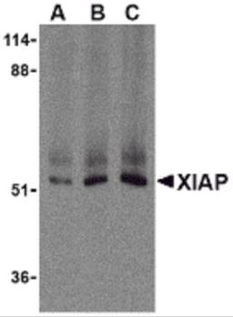 Western blot analysis of XIAP in human kidney lysate with XIAP antibody at (A) 0.5, (B) 1 , and (C) 2 μg/mL, respectively.