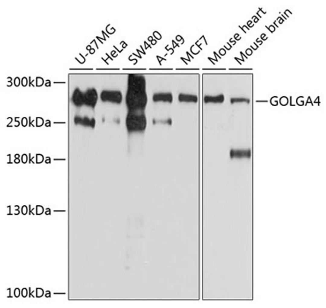 Western blot - GOLGA4 antibody (A10216)