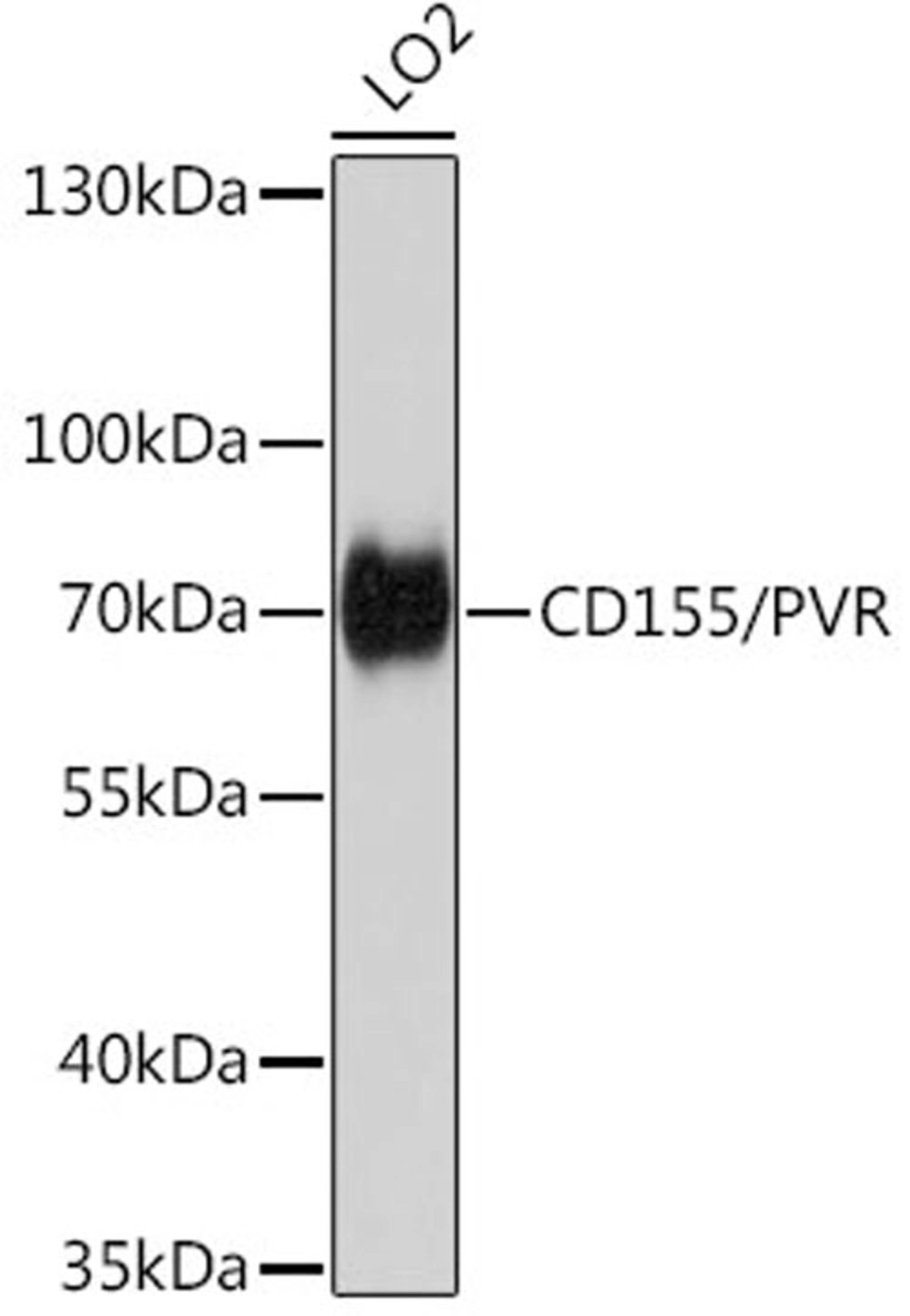 Western blot - CD155/PVR antibody (A5753)