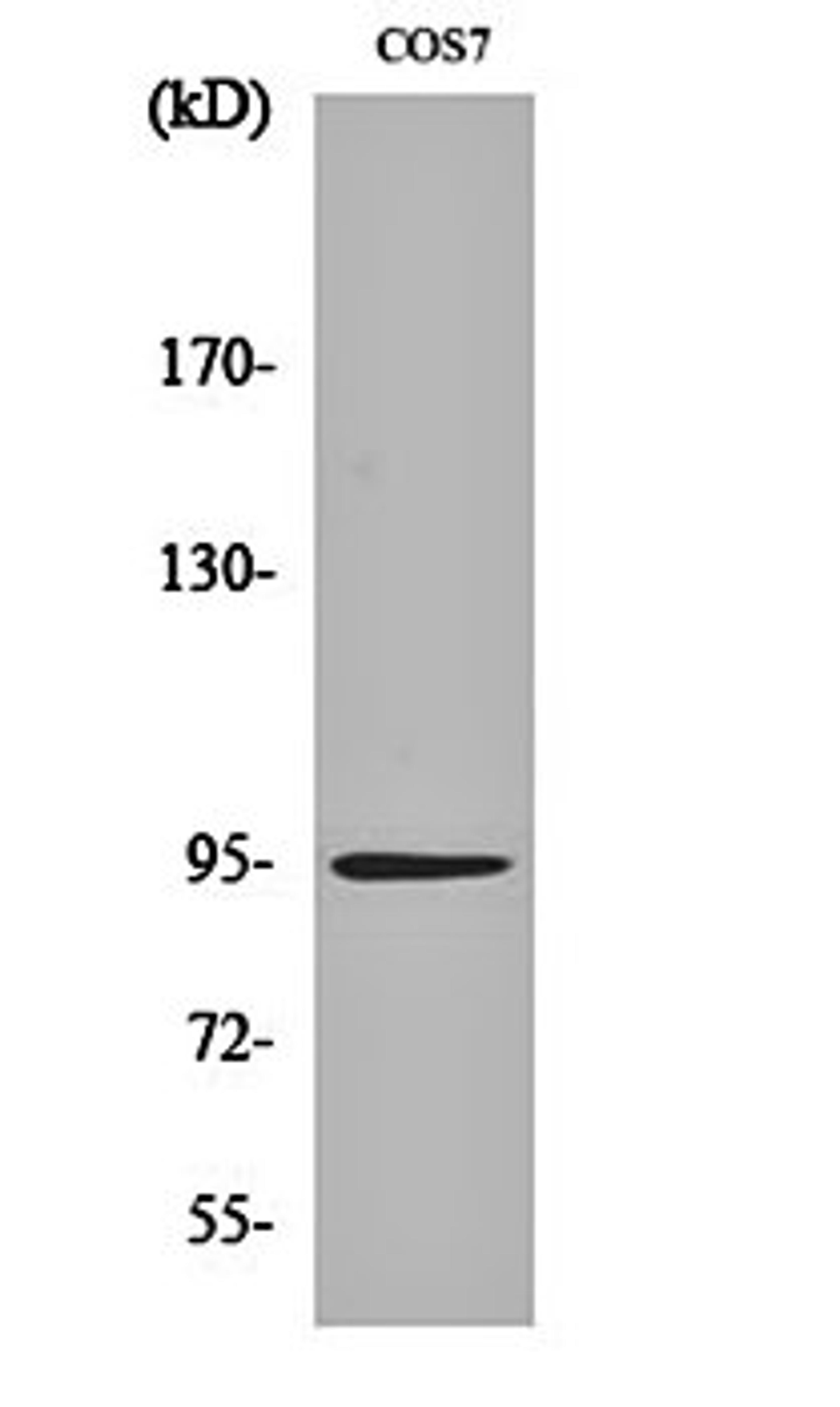 Western blot analysis of COS7 cell lysates using Insulin R antibody