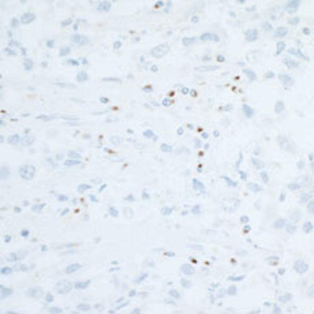 Detection of human CD86 in FFPE seminoma by IHC.