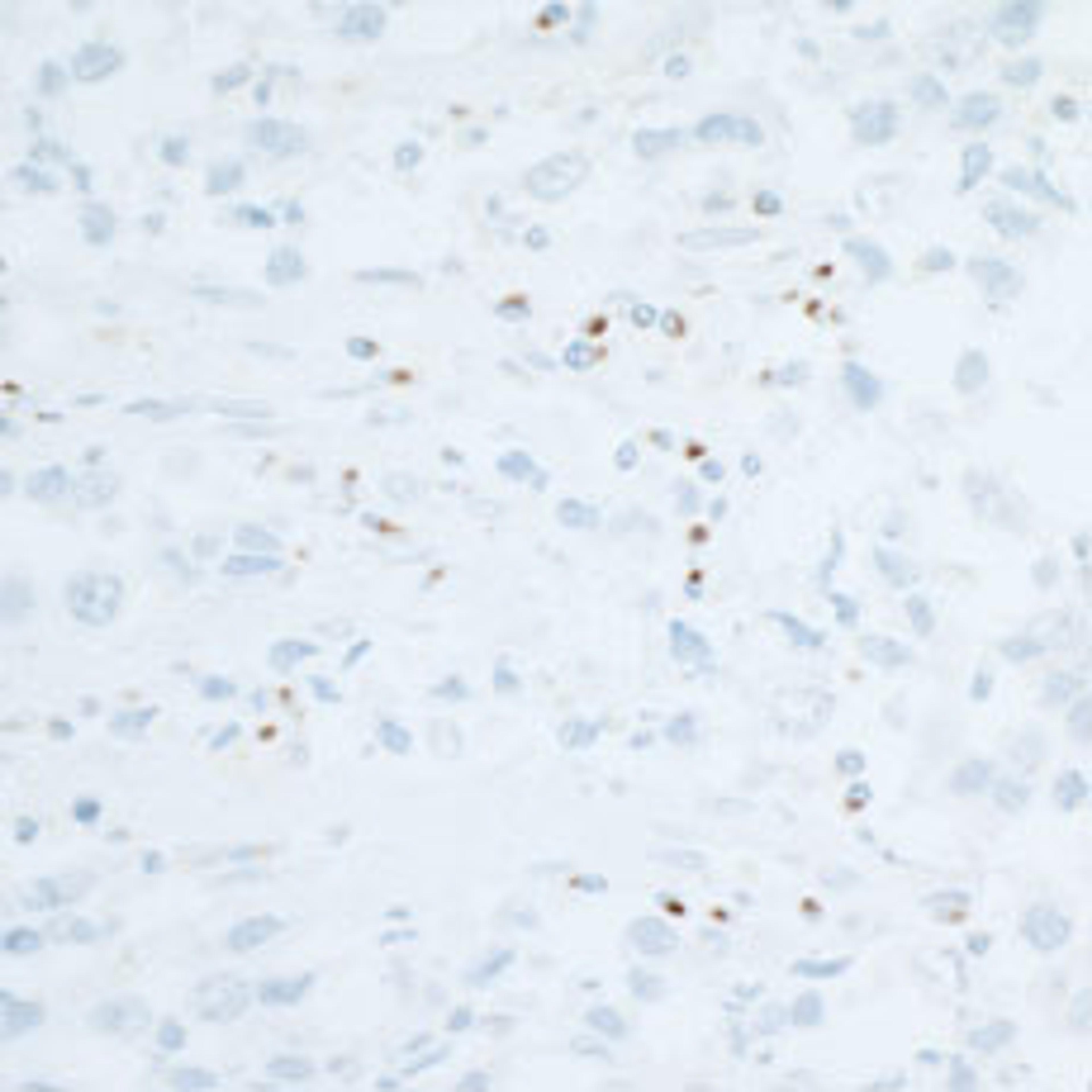 Detection of human CD86 in FFPE seminoma by IHC.