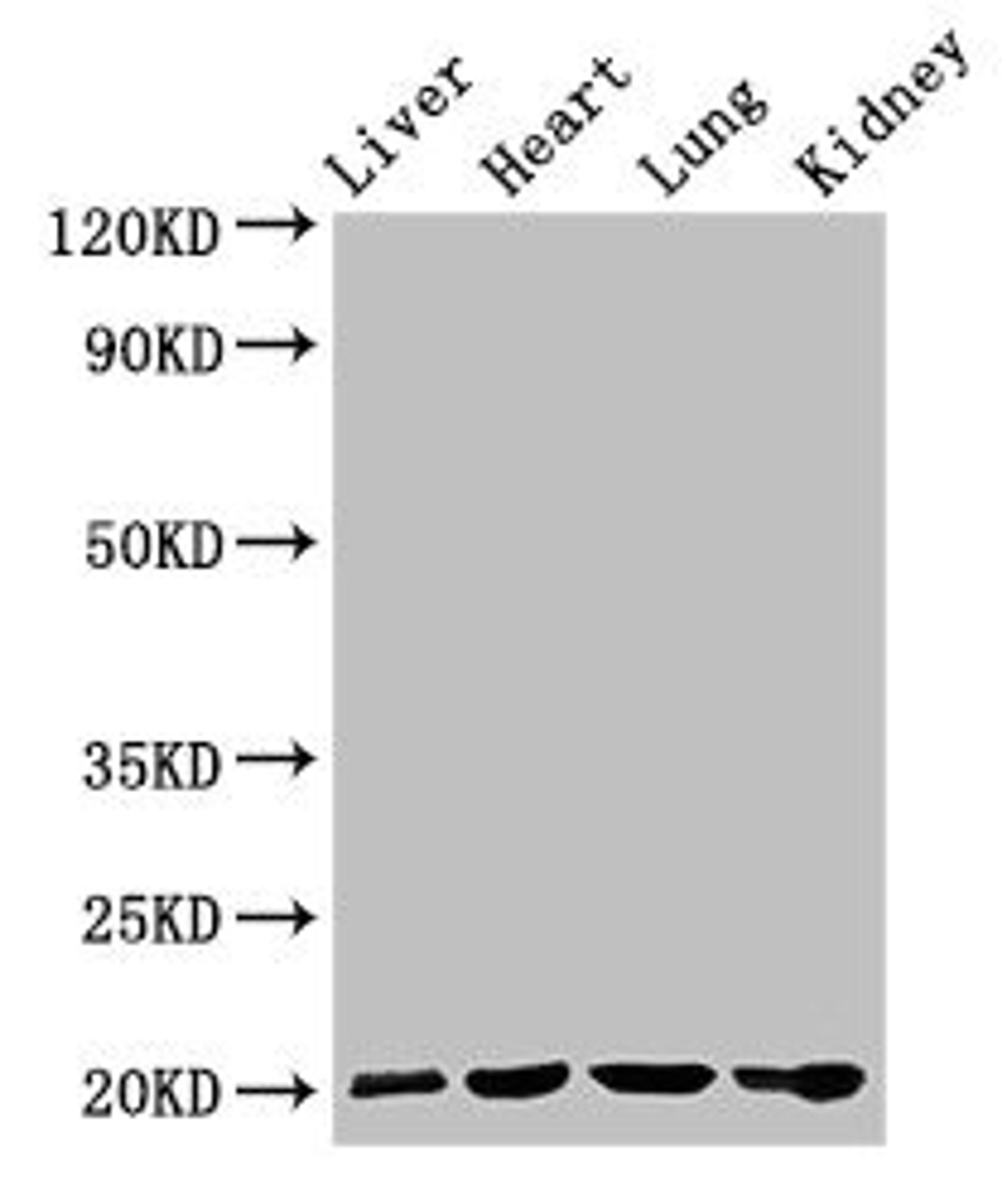 Western Blot. Positive WB detected in: Rat liver tissue, Mouse heart tissue, Mouse lung tissue, Mouse kidney tissue. All lanes: GPIHBP1 antibody at 4ug/ml. Secondary. Goat polyclonal to rabbit IgG at 1/50000 dilution. Predicted band size: 20 kDa. Observed band size: 20 kDa.