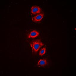 Immunofluorescense analysis of HeLa cells using RPS6 (phospho-S240) antibody