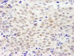 Detection of human XLF by immunohistochemistry.