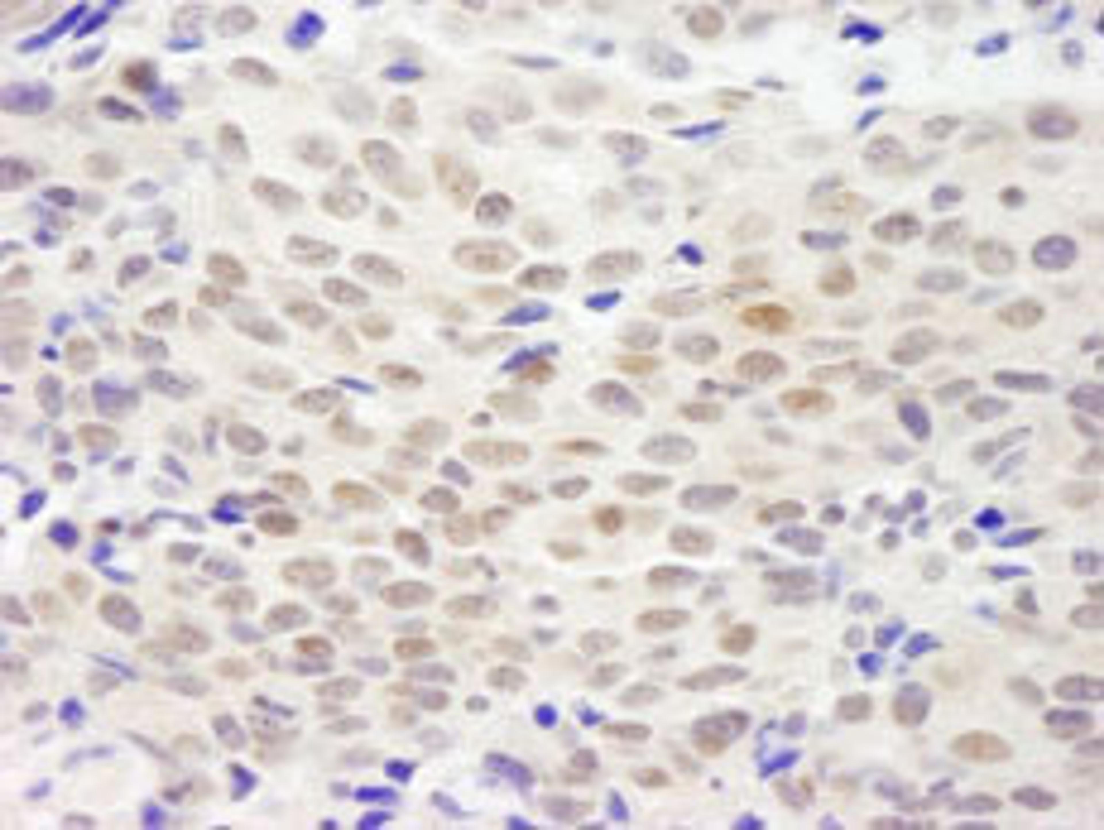 Detection of human XLF by immunohistochemistry.