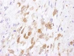 Detection of human SOD1 by immunohistochemistry.