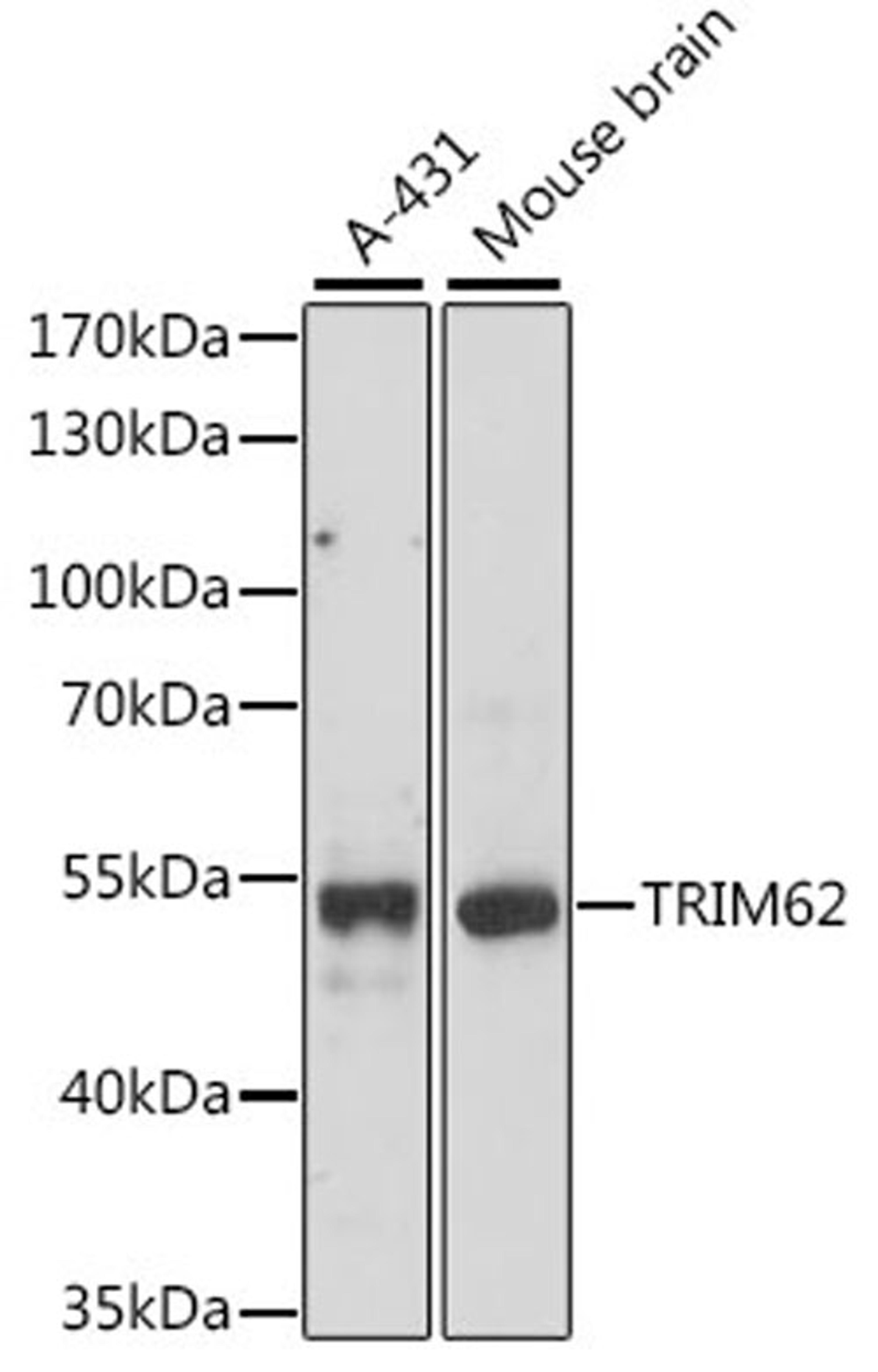 Western blot - TRIM62 antibody (A15855)