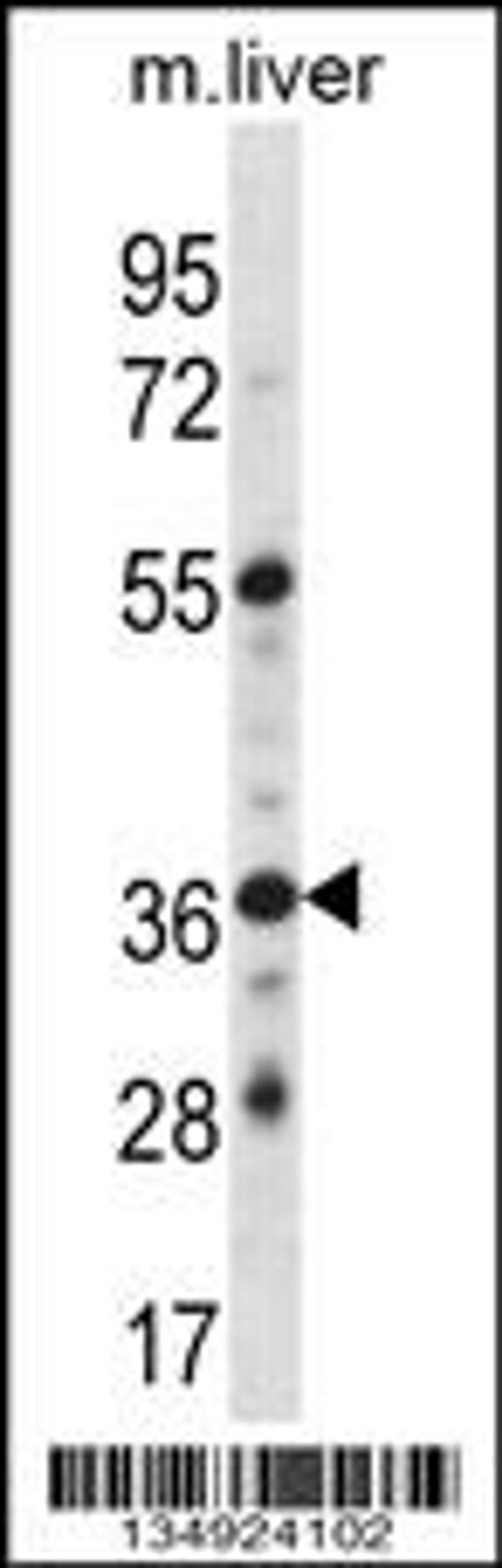 Western blot analysis in mouse liver tissue lysates (35ug/lane).