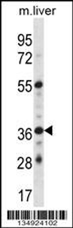 Western blot analysis in mouse liver tissue lysates (35ug/lane).