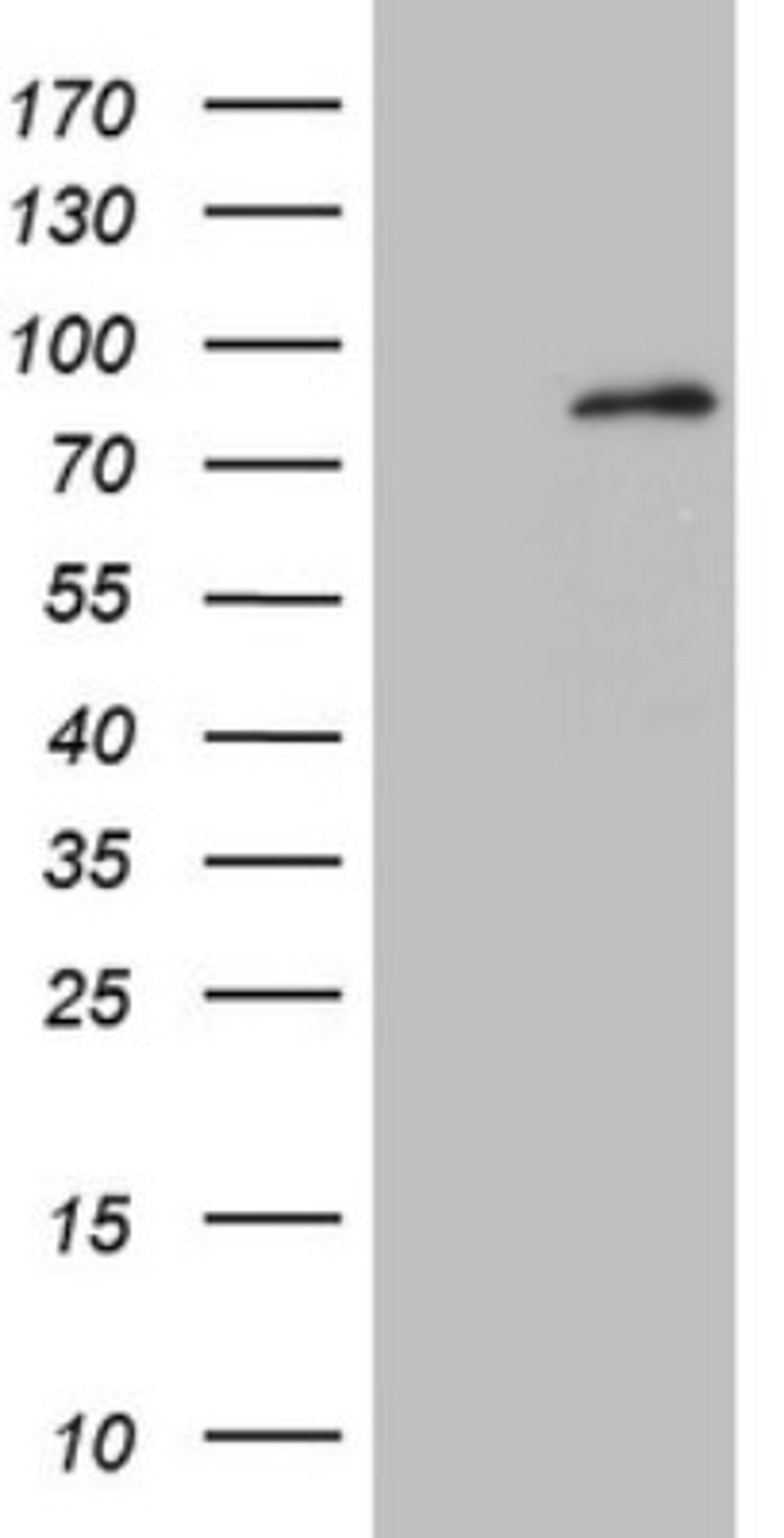 Western Blot: MARK4 Antibody (9B7) [NBP2-45755] - Analysis of HEK293T cells were transfected with the pCMV6-ENTRY control (Left lane) or pCMV6-ENTRY MARK4.