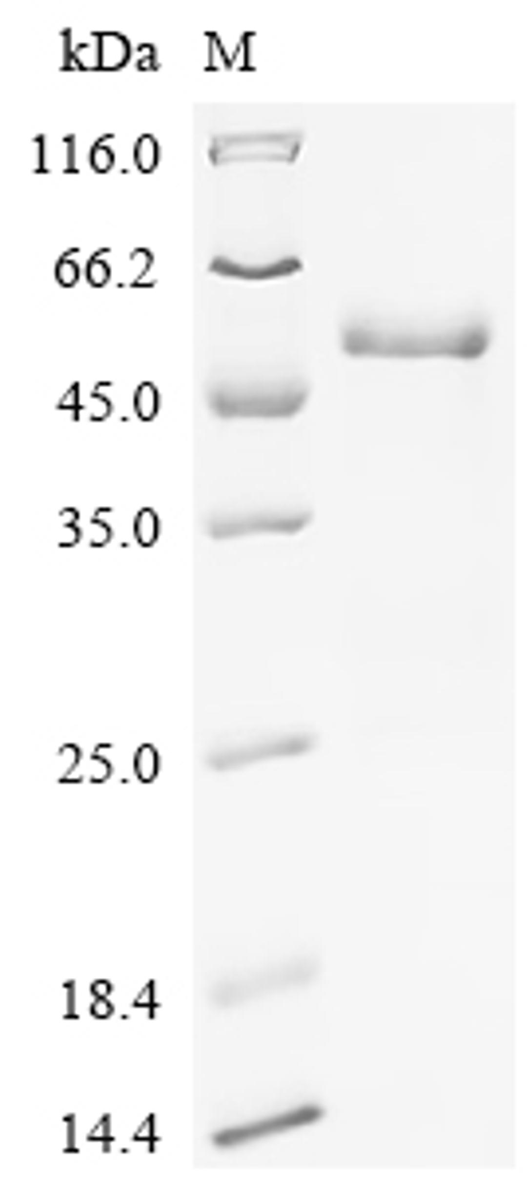 (Tris-Glycine gel) Discontinuous SDS-PAGE (reduced) with 5% enrichment gel and 15% separation gel.