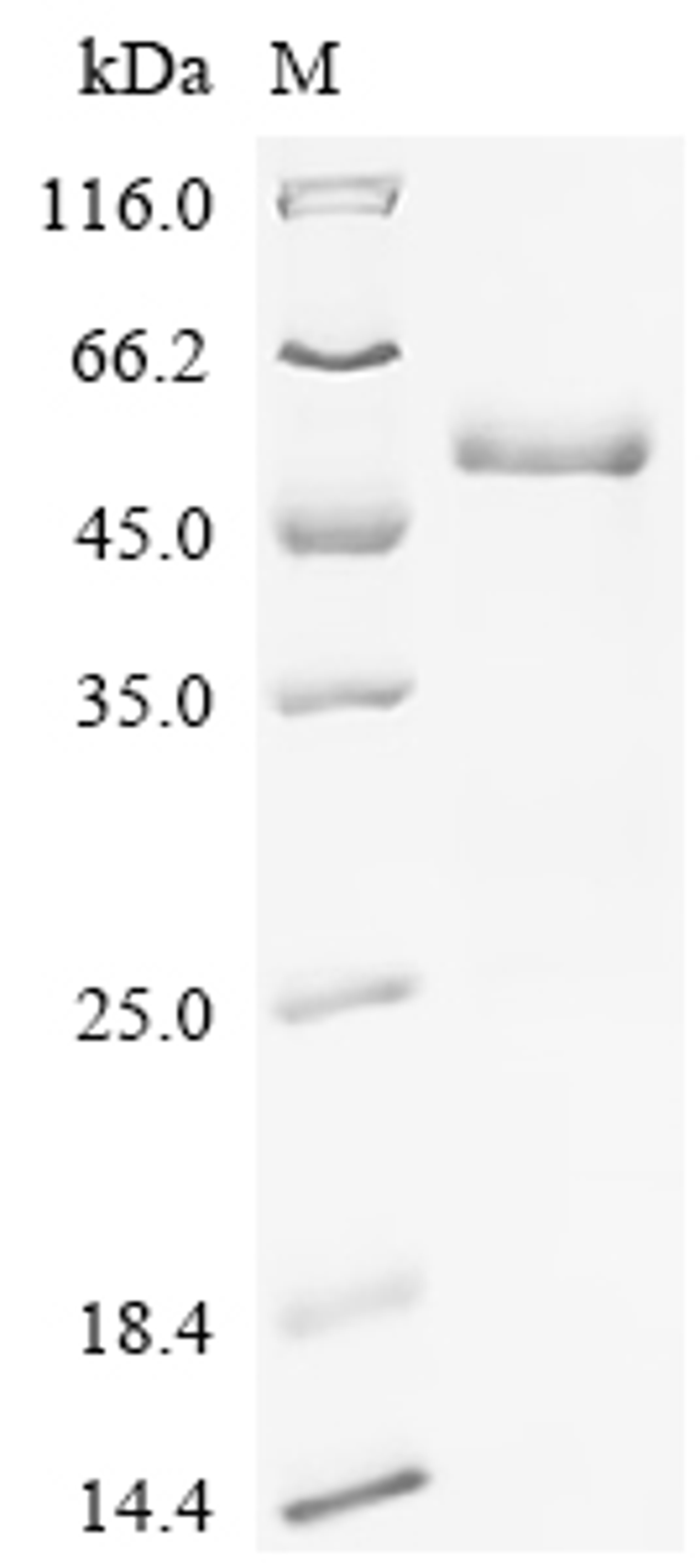 (Tris-Glycine gel) Discontinuous SDS-PAGE (reduced) with 5% enrichment gel and 15% separation gel.