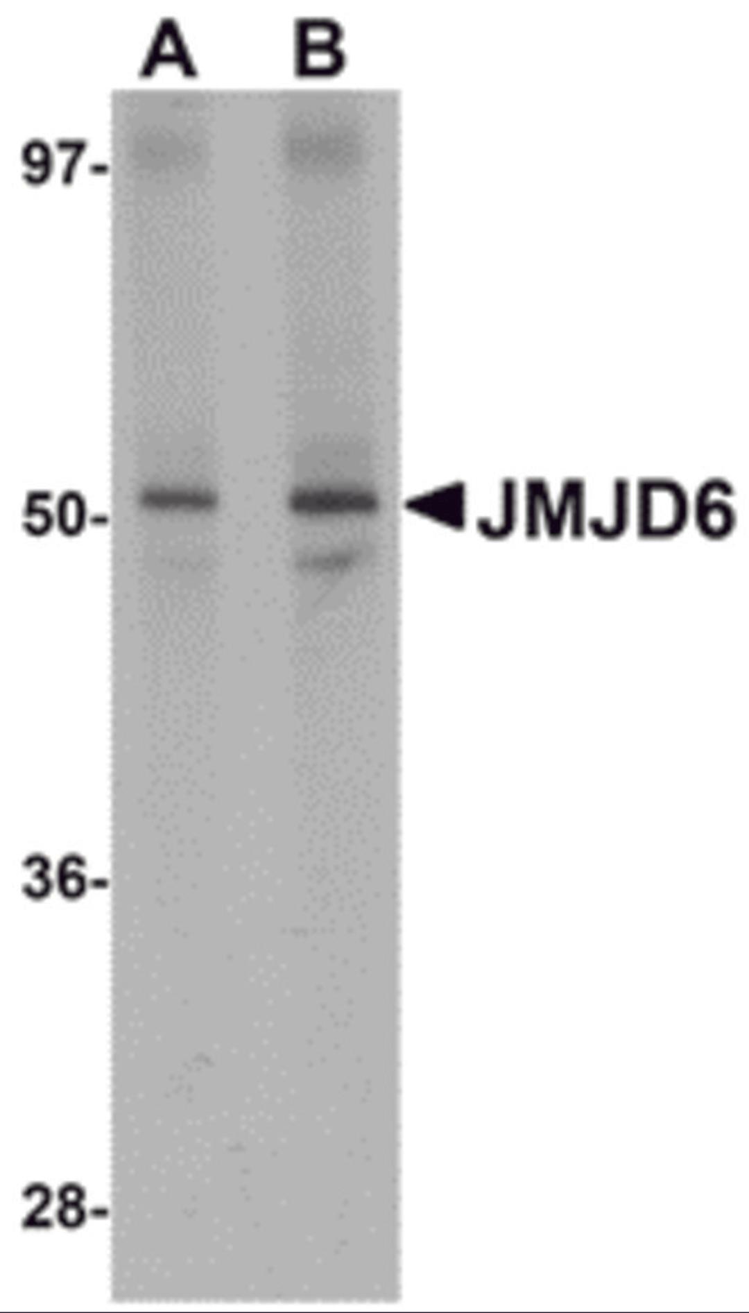 Western blot analysis of JMJD6 in human brain tissue lysate with JMJD6 antibody at (A) 1 and (B) 2 μg/mL.