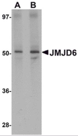 Western blot analysis of JMJD6 in human brain tissue lysate with JMJD6 antibody at (A) 1 and (B) 2 μg/mL.