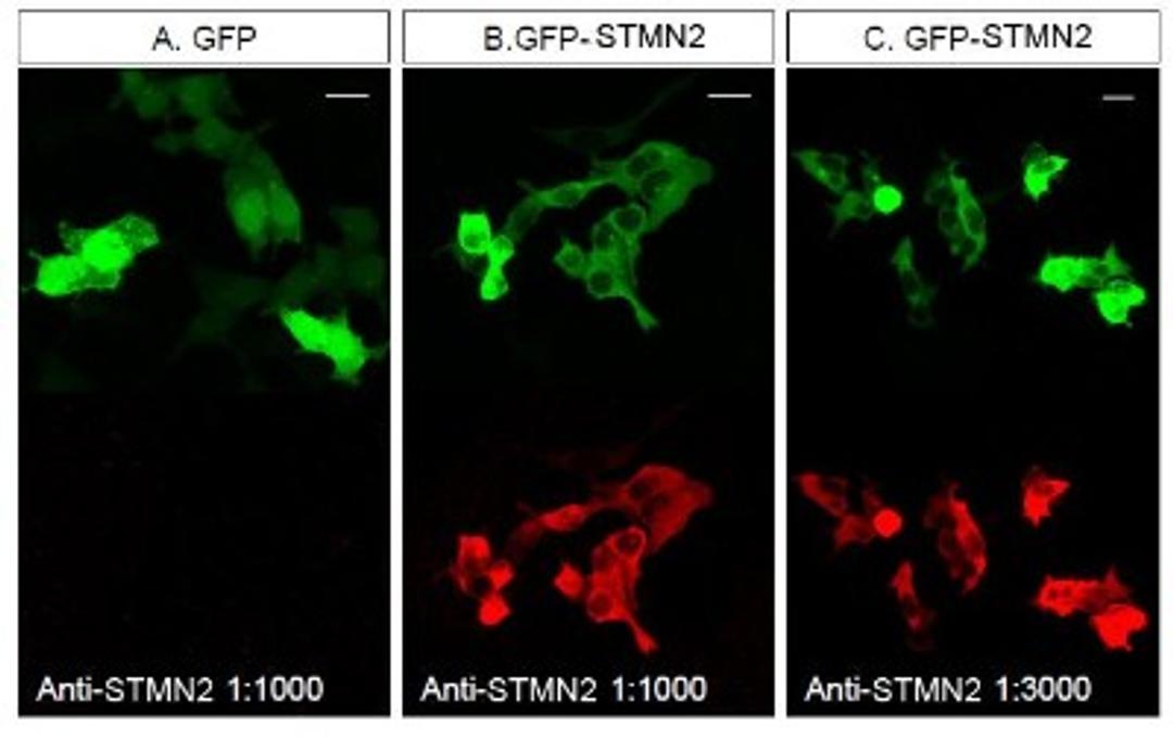 Immunocytochemistry/Immunofluorescence: STMN2 Antibody [NBP1-49461] - Staining of STMN2 in HEK293T cells transfected with GFP or a GFP-STMN2 fusion.  NBP1-49461 was used at a dilution of 1:1000 (A, B) and 1:3000 (C).  Image courtesy of Dr. Jung Eun Shin.