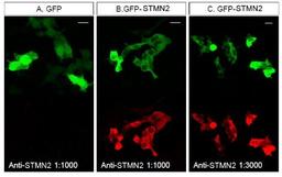 Immunocytochemistry/Immunofluorescence: STMN2 Antibody [NBP1-49461] - Staining of STMN2 in HEK293T cells transfected with GFP or a GFP-STMN2 fusion.  NBP1-49461 was used at a dilution of 1:1000 (A, B) and 1:3000 (C).  Image courtesy of Dr. Jung Eun Shin.