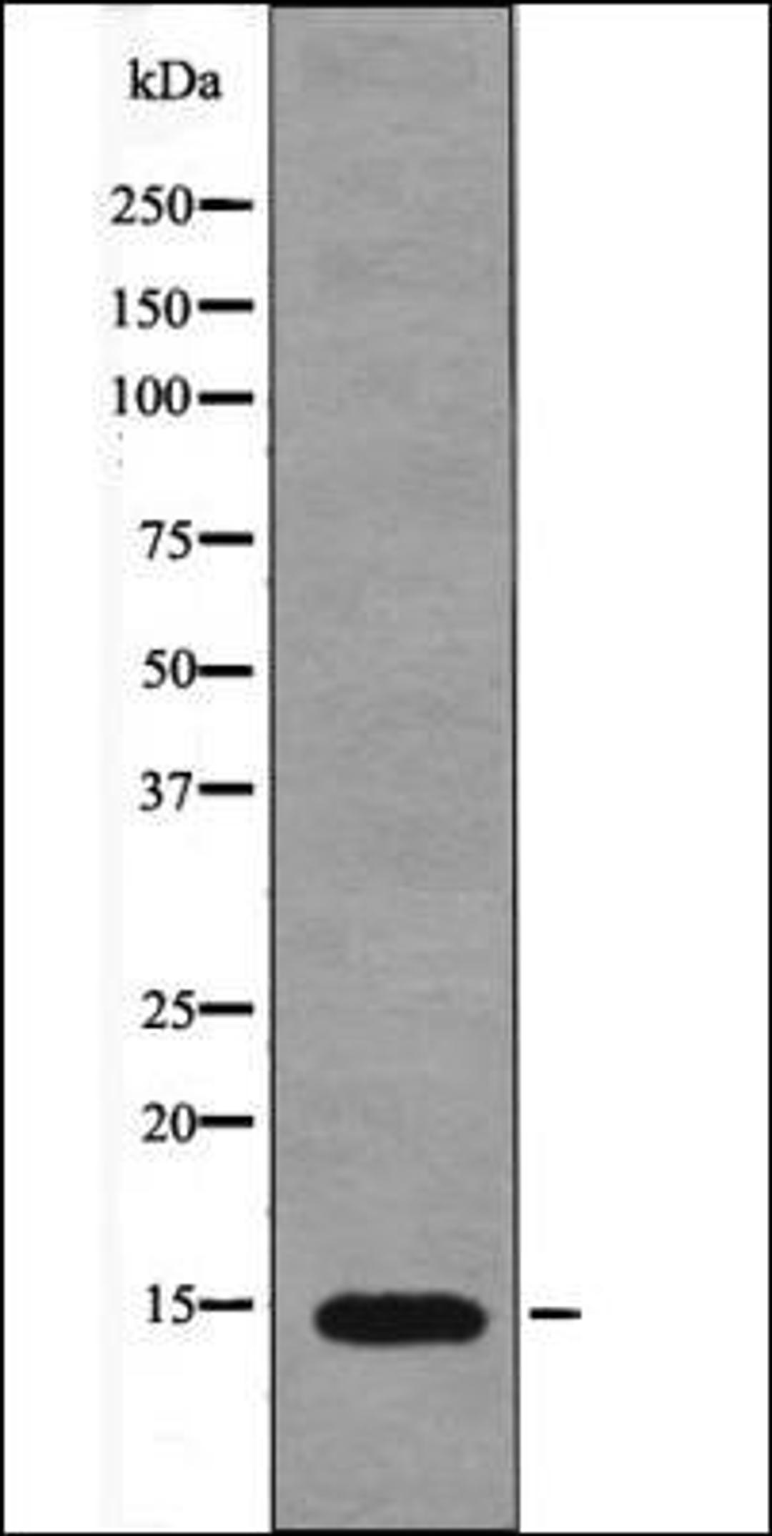 Western blot analysis of PMA treated Jurkat whole cell lysates using Histone H2A -Phospho-Ser2- antibody