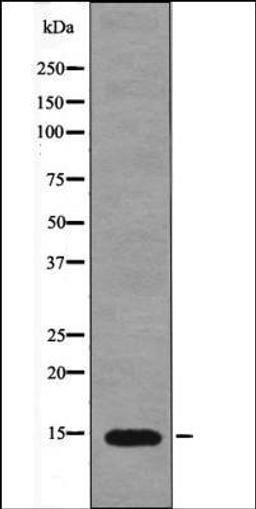 Western blot analysis of PMA treated Jurkat whole cell lysates using Histone H2A -Phospho-Ser2- antibody