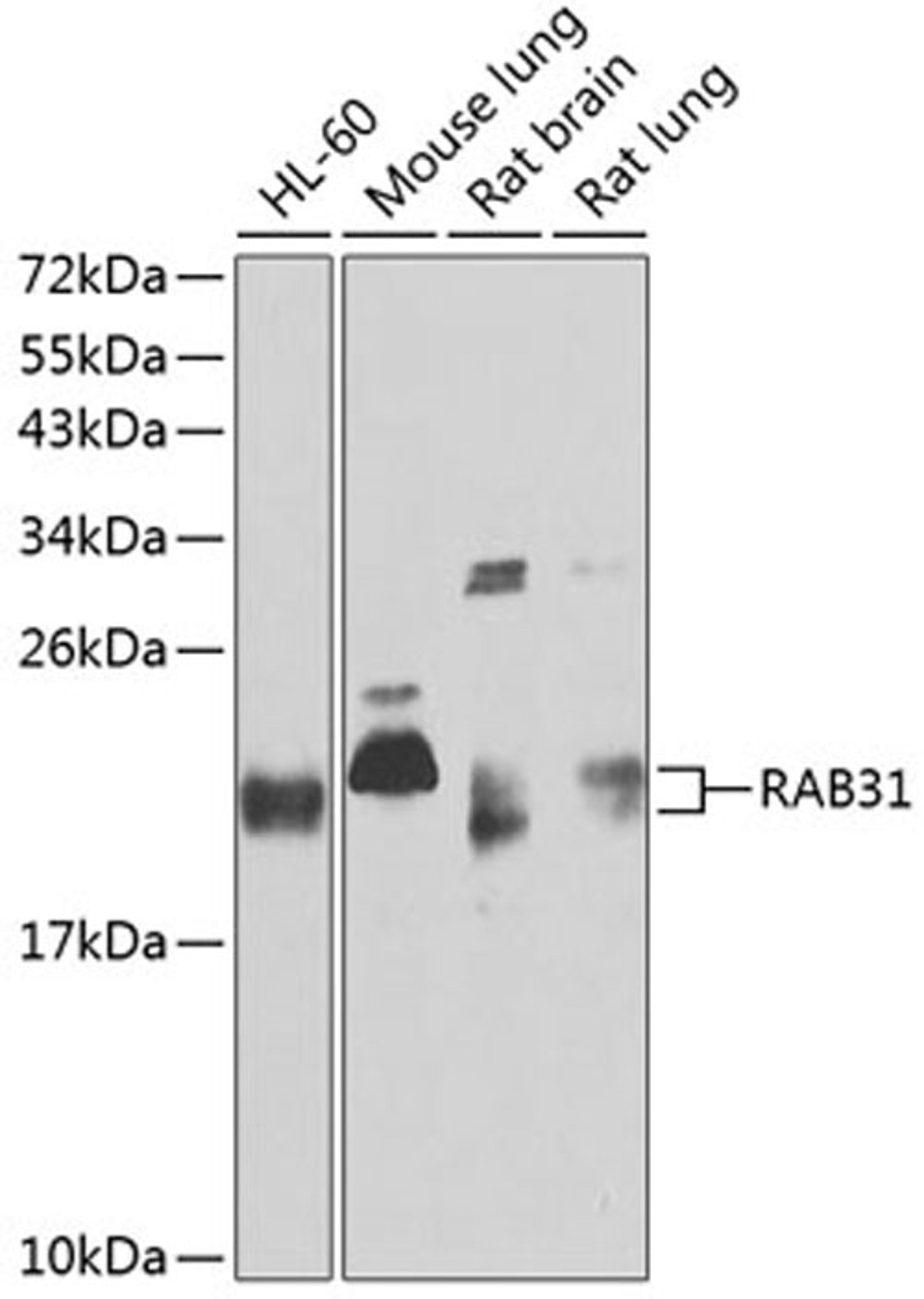 Western blot - RAB31 antibody (A3667)
