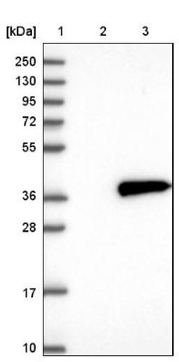 Western Blot: NMRAL1 Antibody [NBP1-83554] - Lane 1: Marker [kDa] 250, 130, 95, 72, 55, 36, 28, 17, 10<br/>Lane 2: Negative control (vector only transfected HEK293T lysate)<br/>Lane 3: Over-expression lysate (Co-expressed with a C-terminal myc-DDK tag (~3.1 kDa) in mammalian HEK293T cells, LY412311)