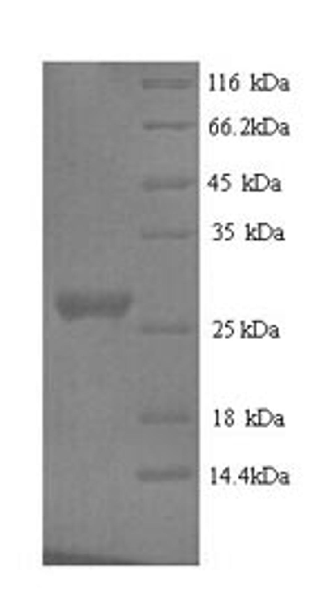 (Tris-Glycine gel) Discontinuous SDS-PAGE (reduced) with 5% enrichment gel and 15% separation gel.