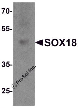 Western blot analysis of SOX18 in 3T3 cell lysate with SOX18 antibody at 1 &#956;g/ml.