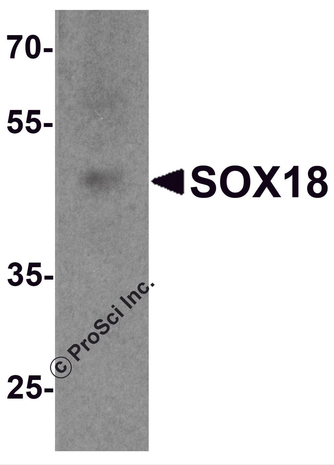 Western blot analysis of SOX18 in 3T3 cell lysate with SOX18 antibody at 1 μg/ml.
