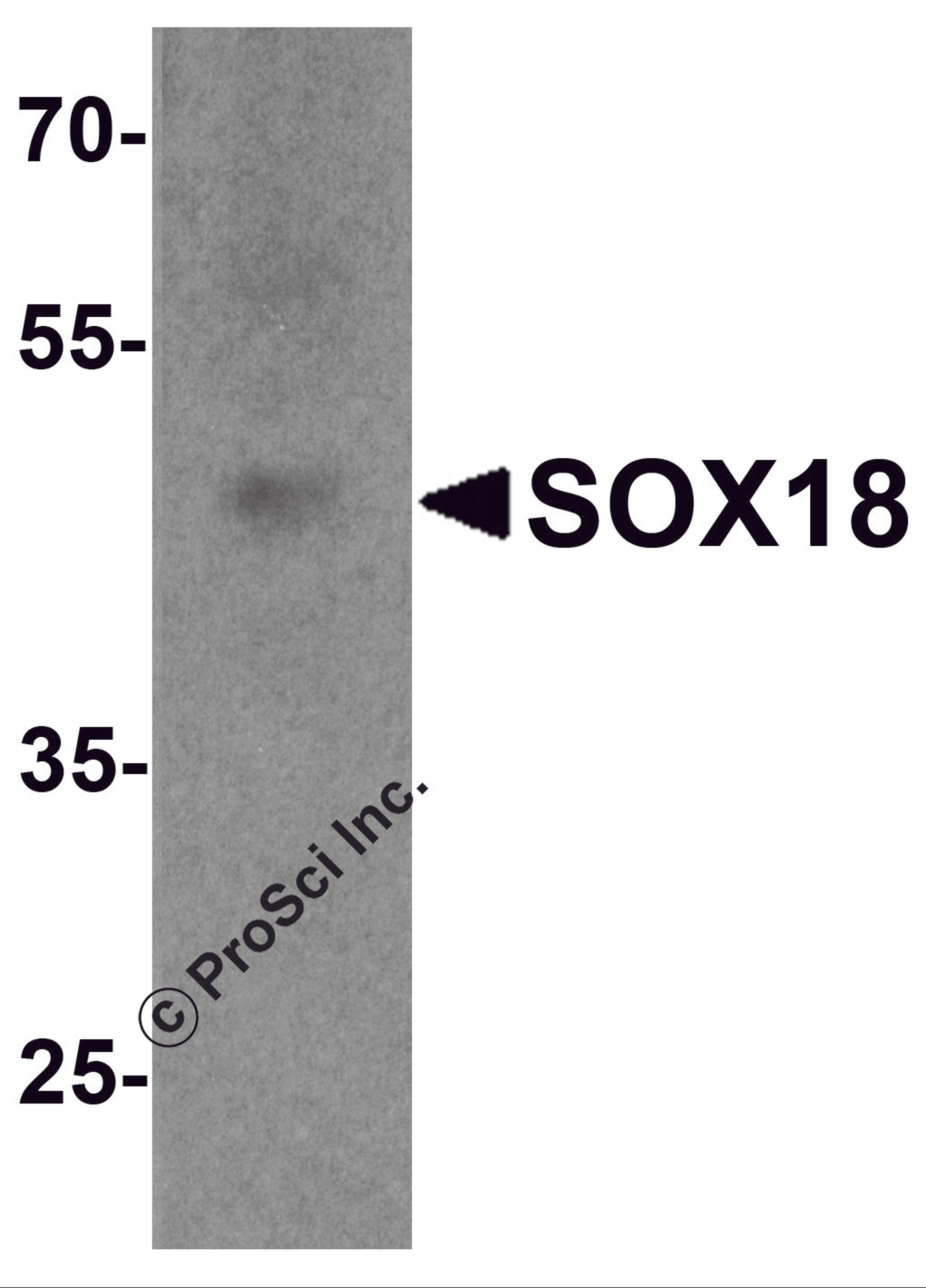 Western blot analysis of SOX18 in 3T3 cell lysate with SOX18 antibody at 1 μg/ml.