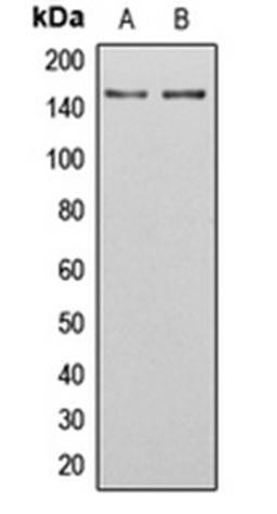 Western blot analysis of U251MG (Lane 1), HeLa (Lane 2) whole cell lysates using SGK223 antibody