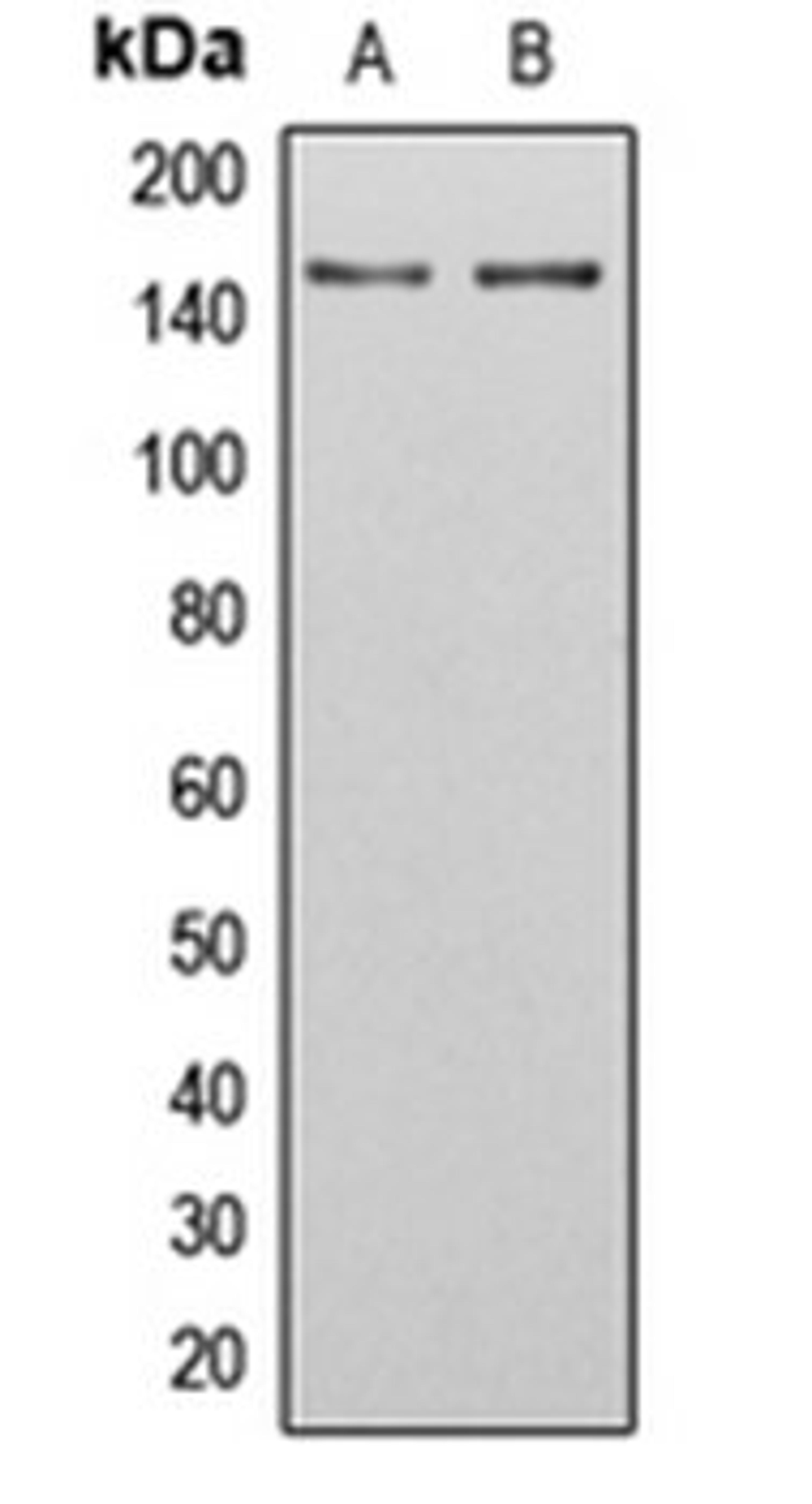 Western blot analysis of U251MG (Lane 1), HeLa (Lane 2) whole cell lysates using SGK223 antibody