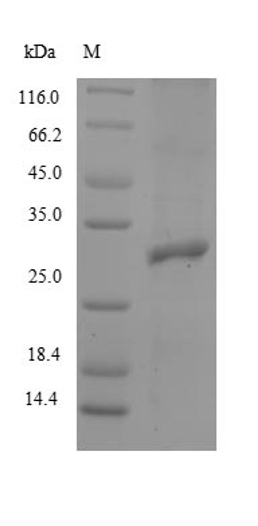 (Tris-Glycine gel) Discontinuous SDS-PAGE (reduced) with 5% enrichment gel and 15% separation gel.
