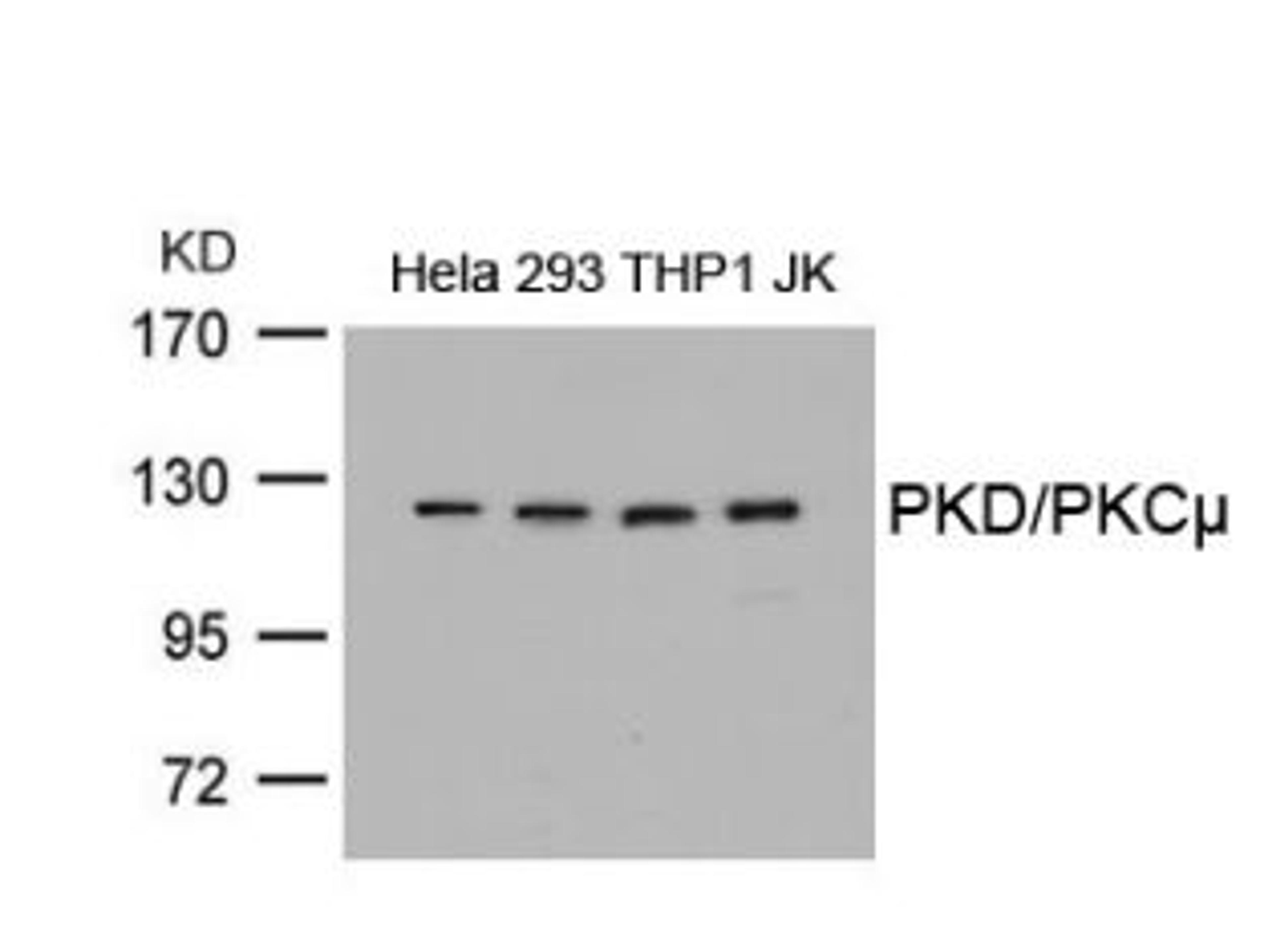Western blot analysis of lysed extracts from HeLa, 293, THP1 and JK cells using PKD/PKCμ (Ab-738).