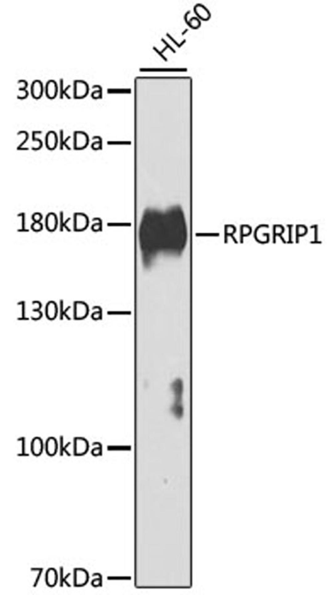 Western blot - RPGRIP1 antibody (A7477)