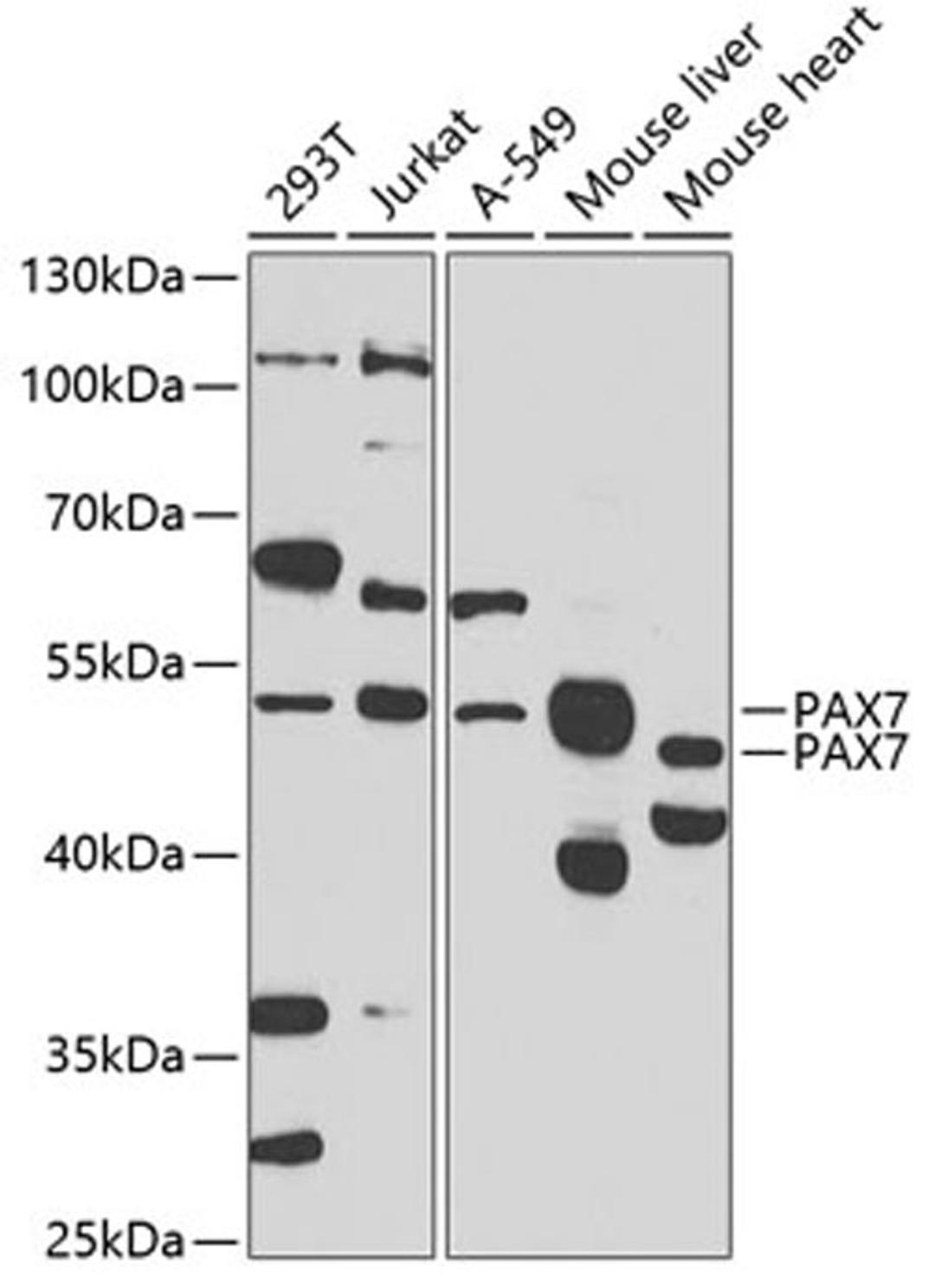 Western blot - PAX7 antibody (A7335)