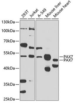 Western blot - PAX7 antibody (A7335)