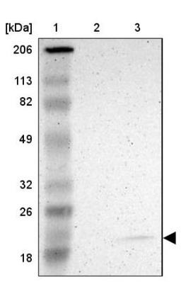 Western Blot: JM4 Antibody [NBP1-87886] - Lane 1: Marker [kDa] 206, 113, 82, 49, 32, 26, 18<br/>Lane 2: Human cell line RT-4<br/>Lane 3: Human cell line U-251MG sp