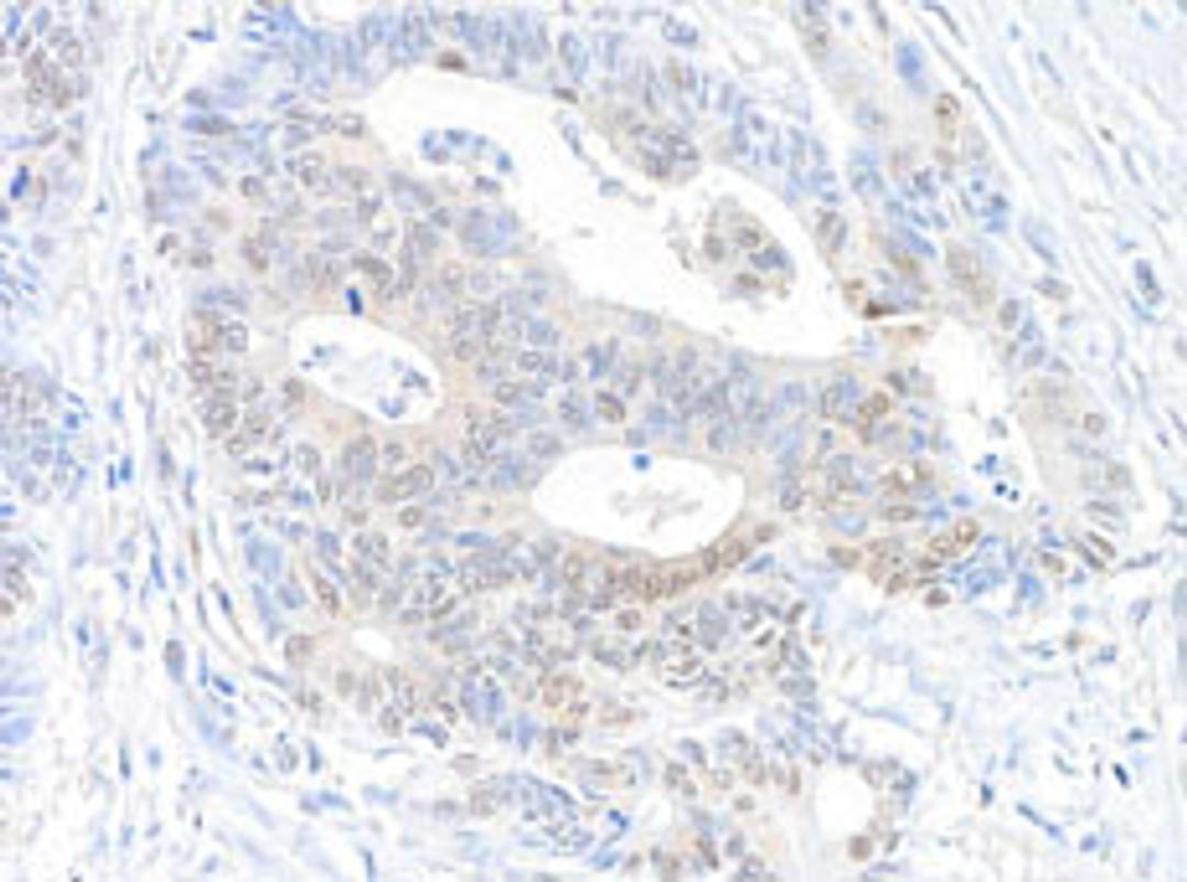 Detection of human RanBP1 by immunohistochemistry.