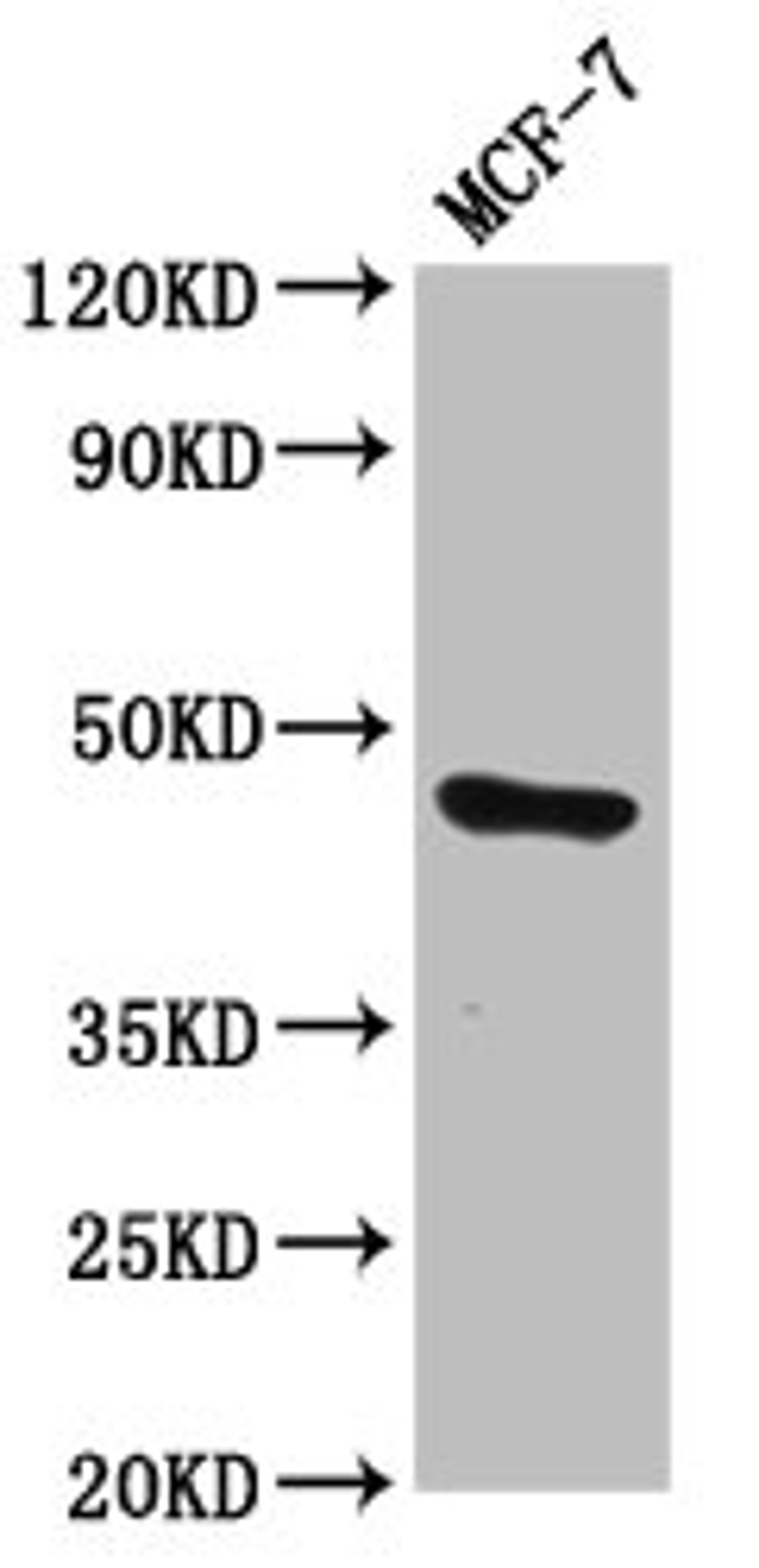 Western Blot. Positive WB detected in: MCF-7 whole cell lysate. All lanes: TFAP2E antibody at 3.63µg/ml. Secondary. Goat polyclonal to rabbit IgG at 1/50000 dilution. Predicted band size: 47 kDa. Observed band size: 47 kDa