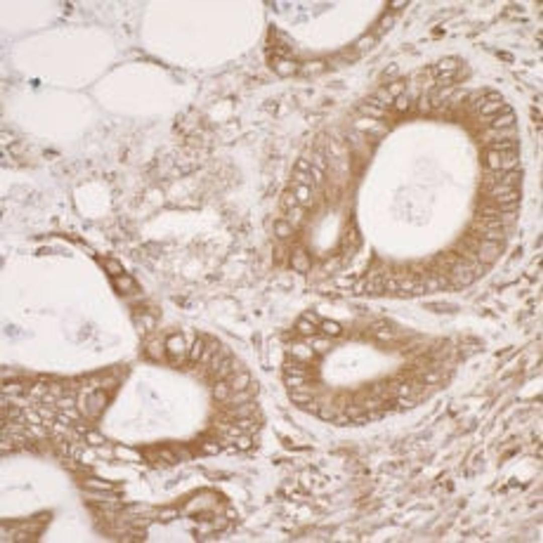 Detection of human PDIA3 by immunohistochemistry.