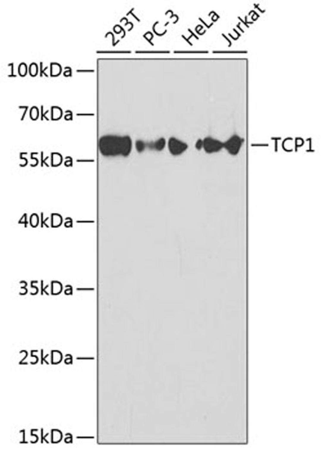 Western blot - TCP1 antibody (A1950)