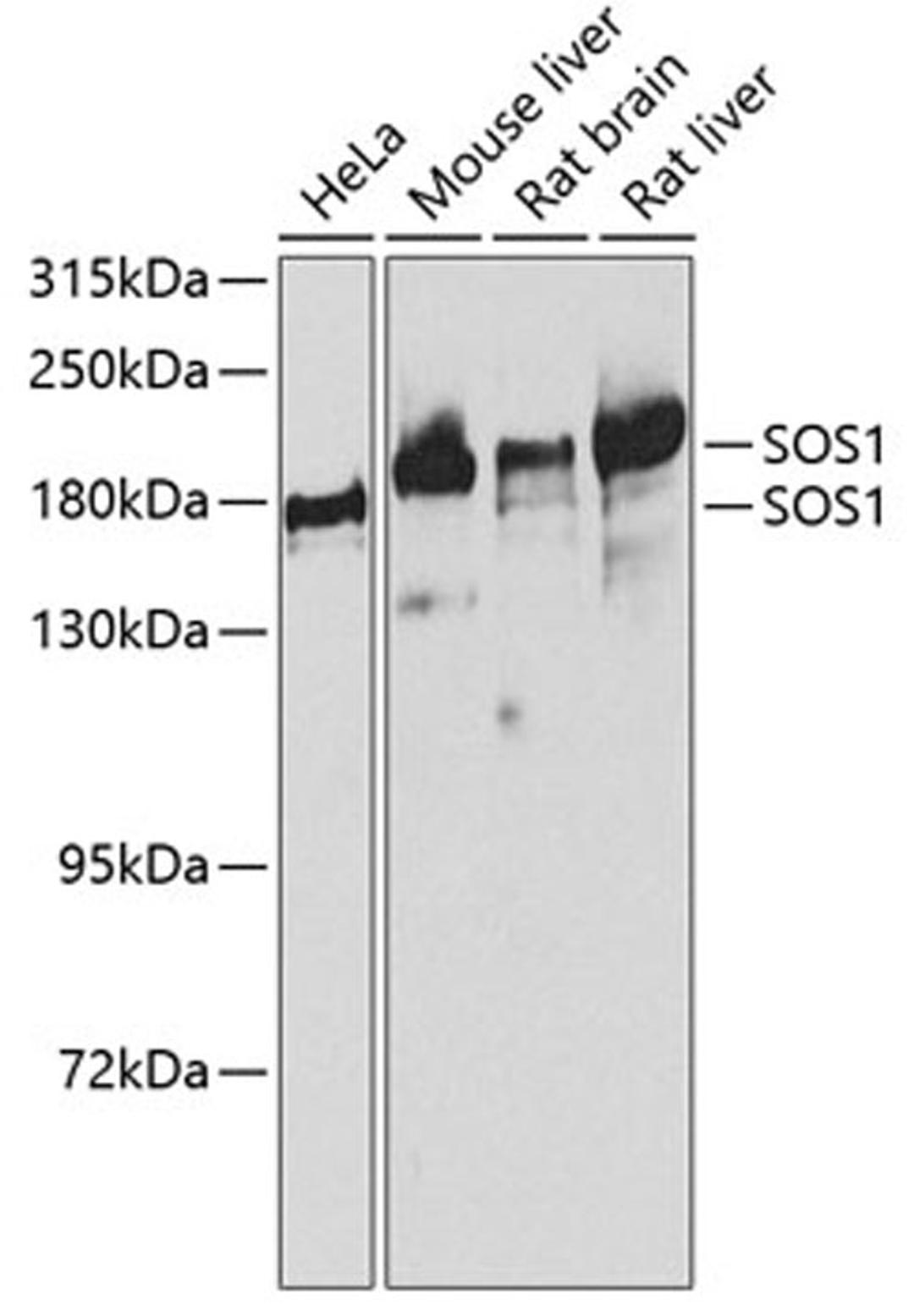 Western blot - SOS1 antibody (A3272)