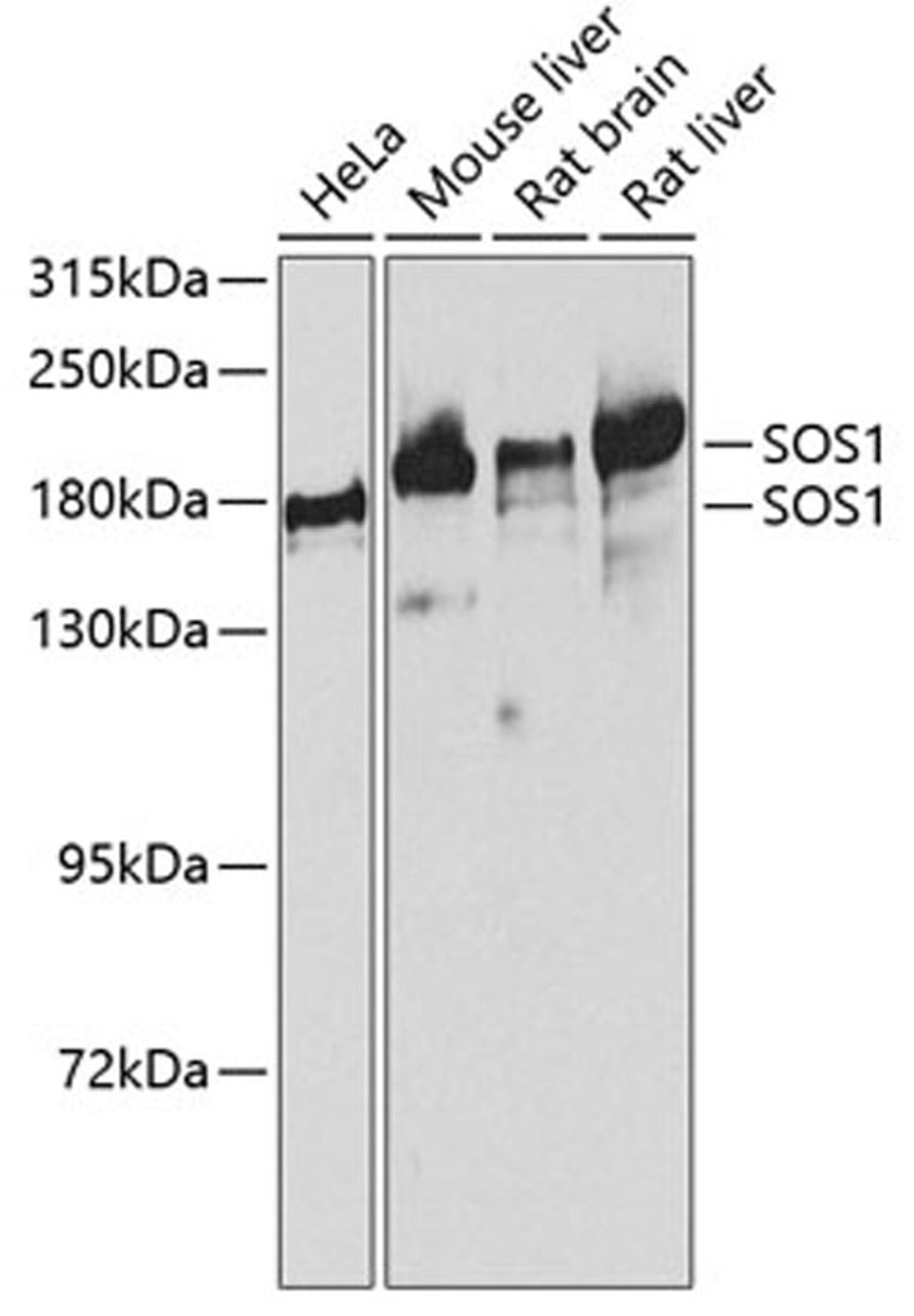 Western blot - SOS1 antibody (A3272)