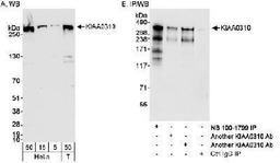 Western Blot: SEC16A Antibody [NB100-1799] - Detection of Human KIAA0310 on HeLa whole cell lysate using NB100-1799. KIAA0310 was also immunoprecipitated by 2 other antibodies.