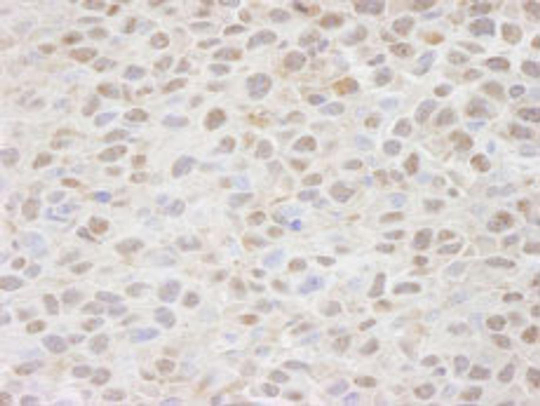 Detection of mouse CSE1 by immunohistochemistry.