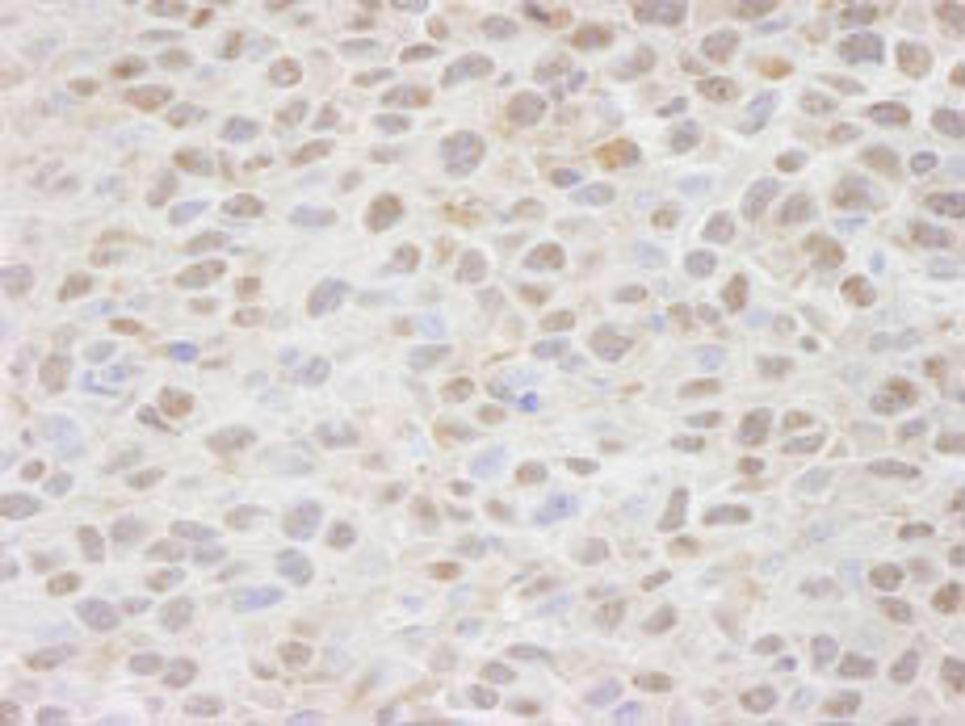 Detection of mouse CSE1 by immunohistochemistry.