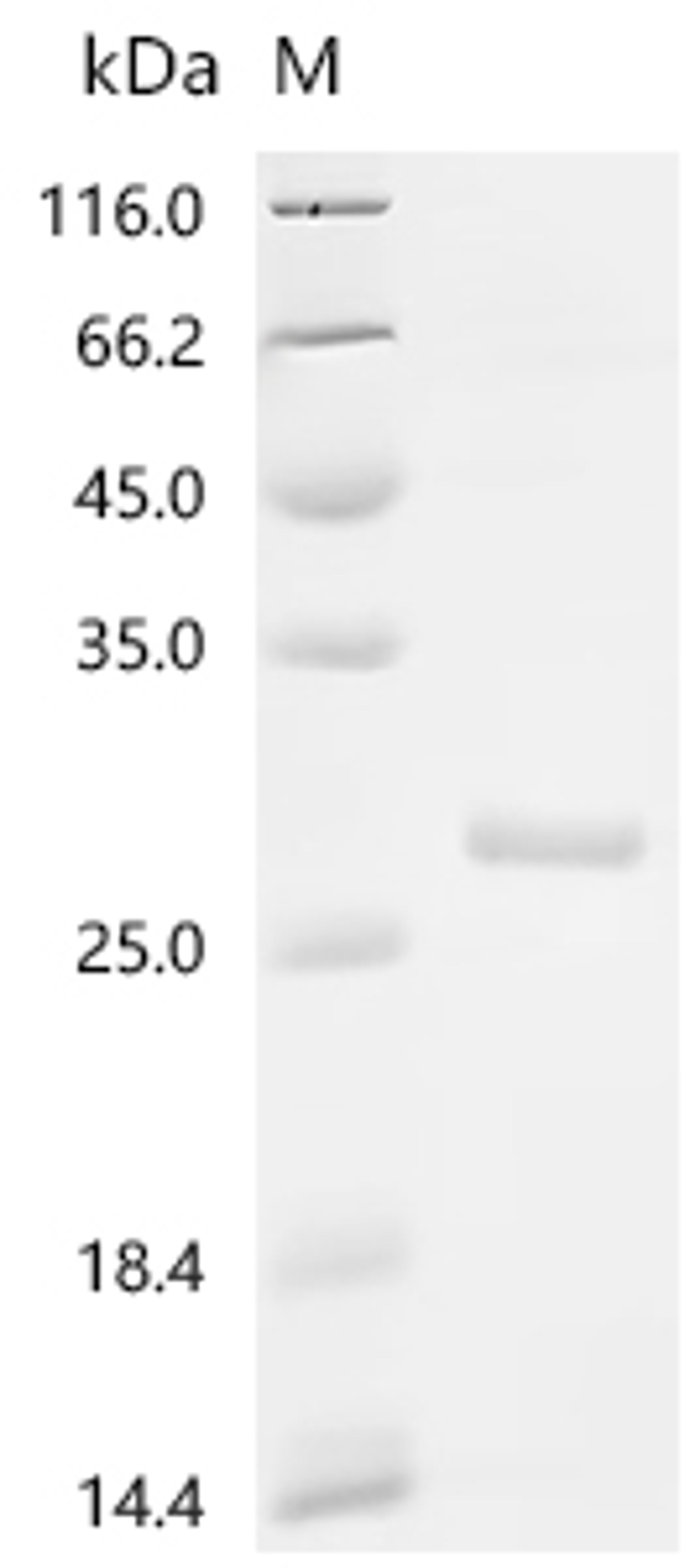 (Tris-Glycine gel) Discontinuous SDS-PAGE (reduced) with 5% enrichment gel and 15% separation gel.