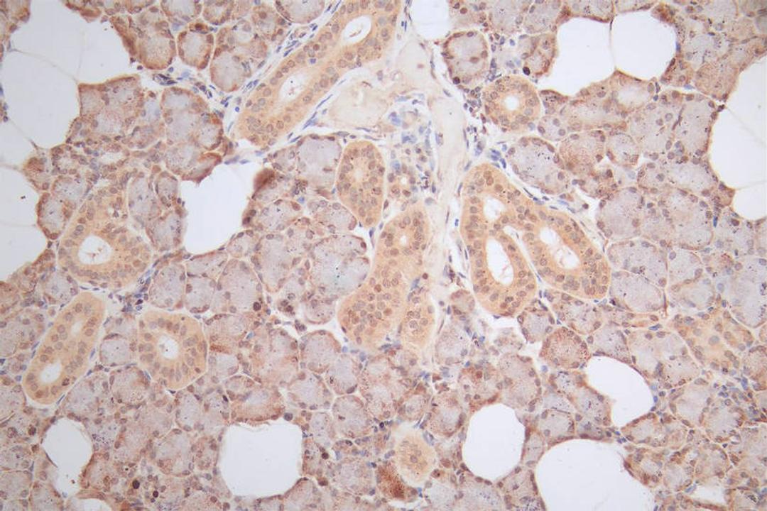 IHC image of CSB-RA010553MA1HU diluted at 1:100 and staining in paraffin-embedded human salivary gland tissue performed on a Leica BondTM system. After dewaxing and hydration,  antigen retrieval was mediated by high pressure in a citrate buffer (pH 6.0). Section was blocked with 10% normal goat serum 30min at RT. Then primary antibody (1% BSA) was incubated at 4°C overnight. The primary is detected by a Goat anti-Mouse IgG labeled by HRP and visualized using 0.05% DAB.
