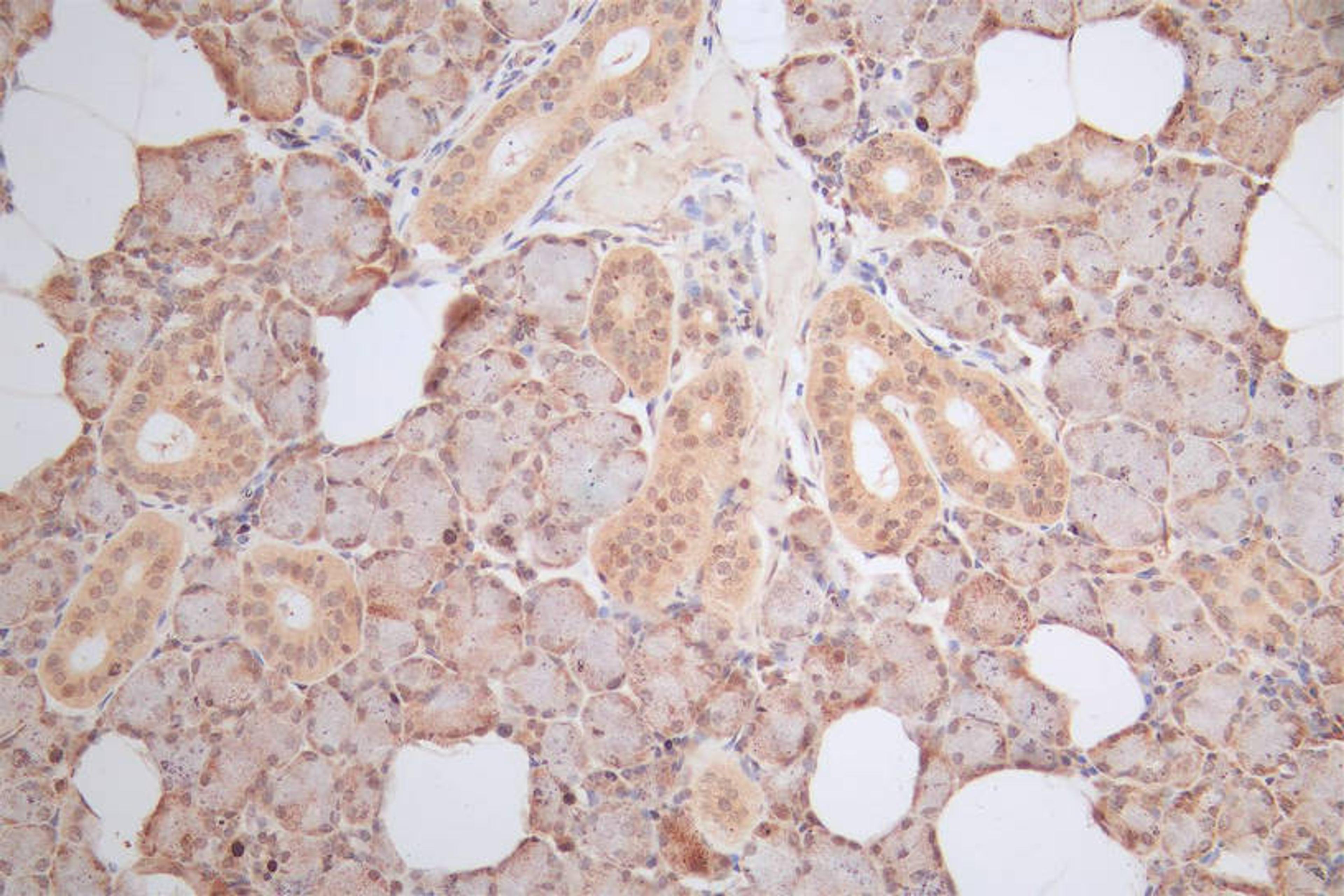 IHC image of CSB-RA010553MA1HU diluted at 1:100 and staining in paraffin-embedded human salivary gland tissue performed on a Leica BondTM system. After dewaxing and hydration,  antigen retrieval was mediated by high pressure in a citrate buffer (pH 6.0). Section was blocked with 10% normal goat serum 30min at RT. Then primary antibody (1% BSA) was incubated at 4°C overnight. The primary is detected by a Goat anti-Mouse IgG labeled by HRP and visualized using 0.05% DAB.